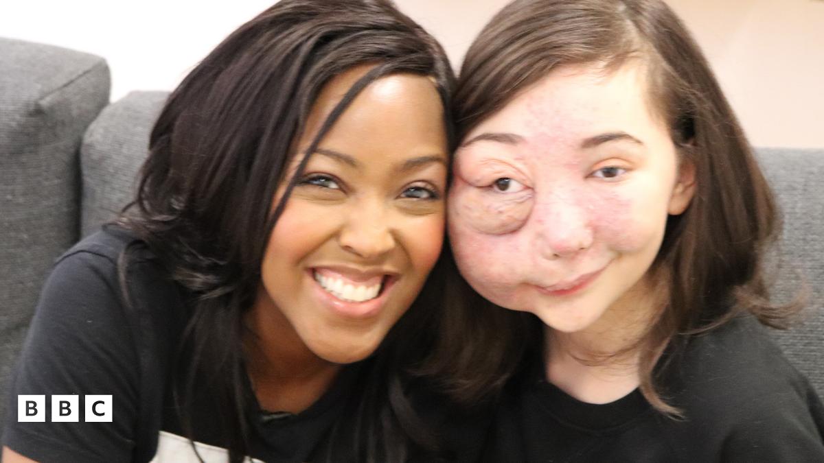 Nikky Lilly Meets Episodes